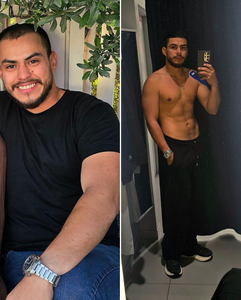 תמונת לפני ואחרי של חיטוב והגדרת שריר